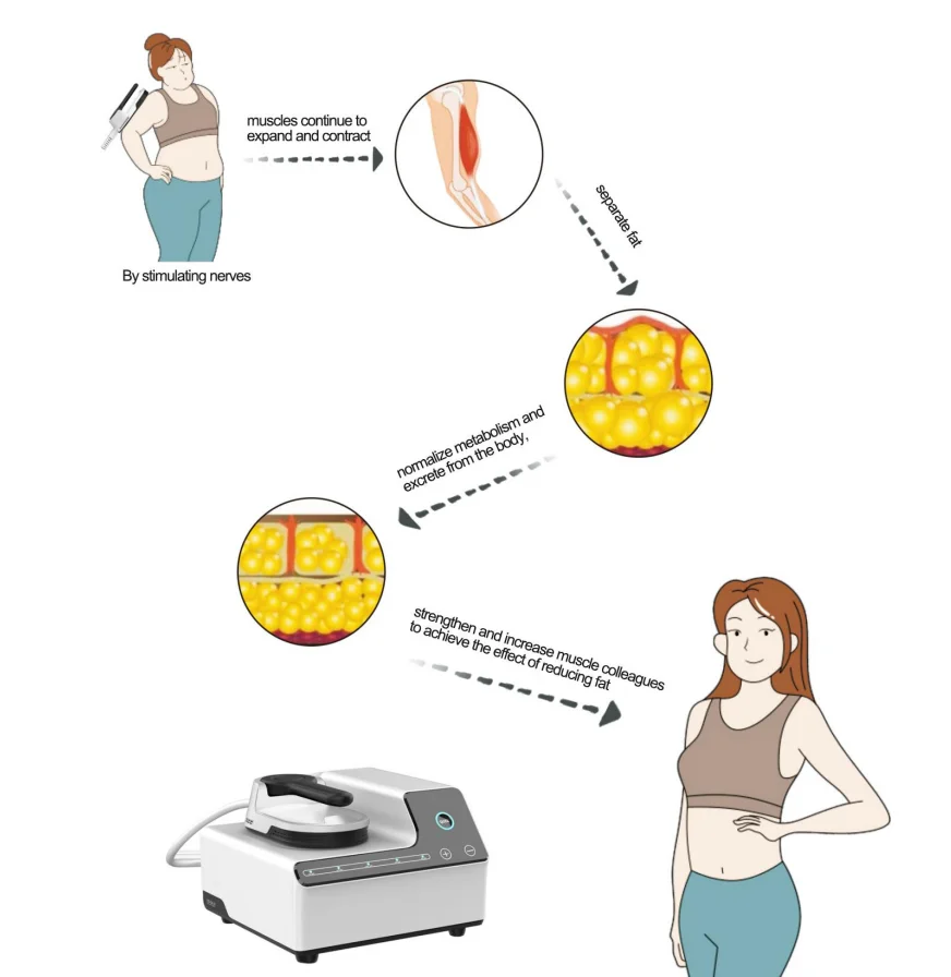 Buttock lifting Skin Tightening Electromagnetic RF Muscle Stimulator Machine