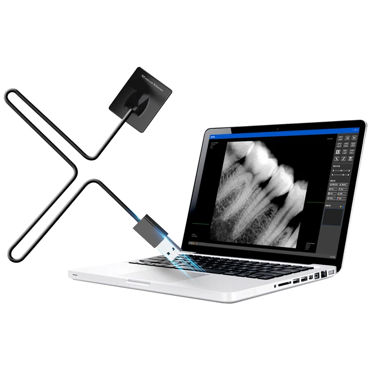 Dental Equipment Rvg Dental Sensor USB Intraoral Xray Sensor Digital Imaging System Wireless Sensor