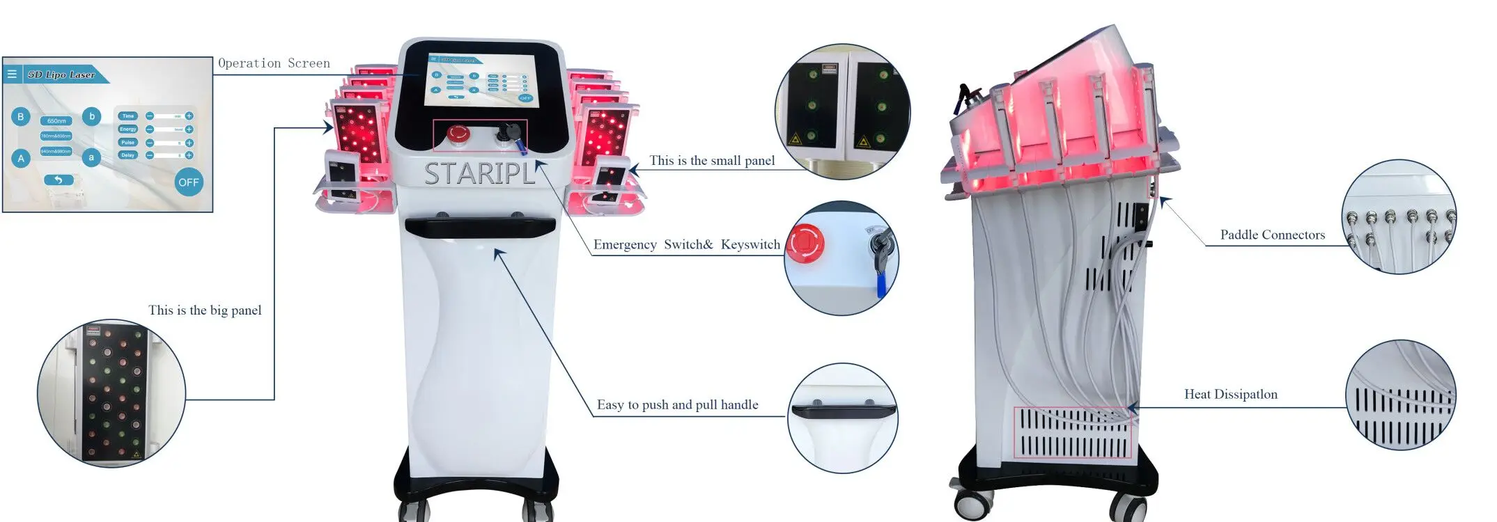 5D lipo laser (3).jpg