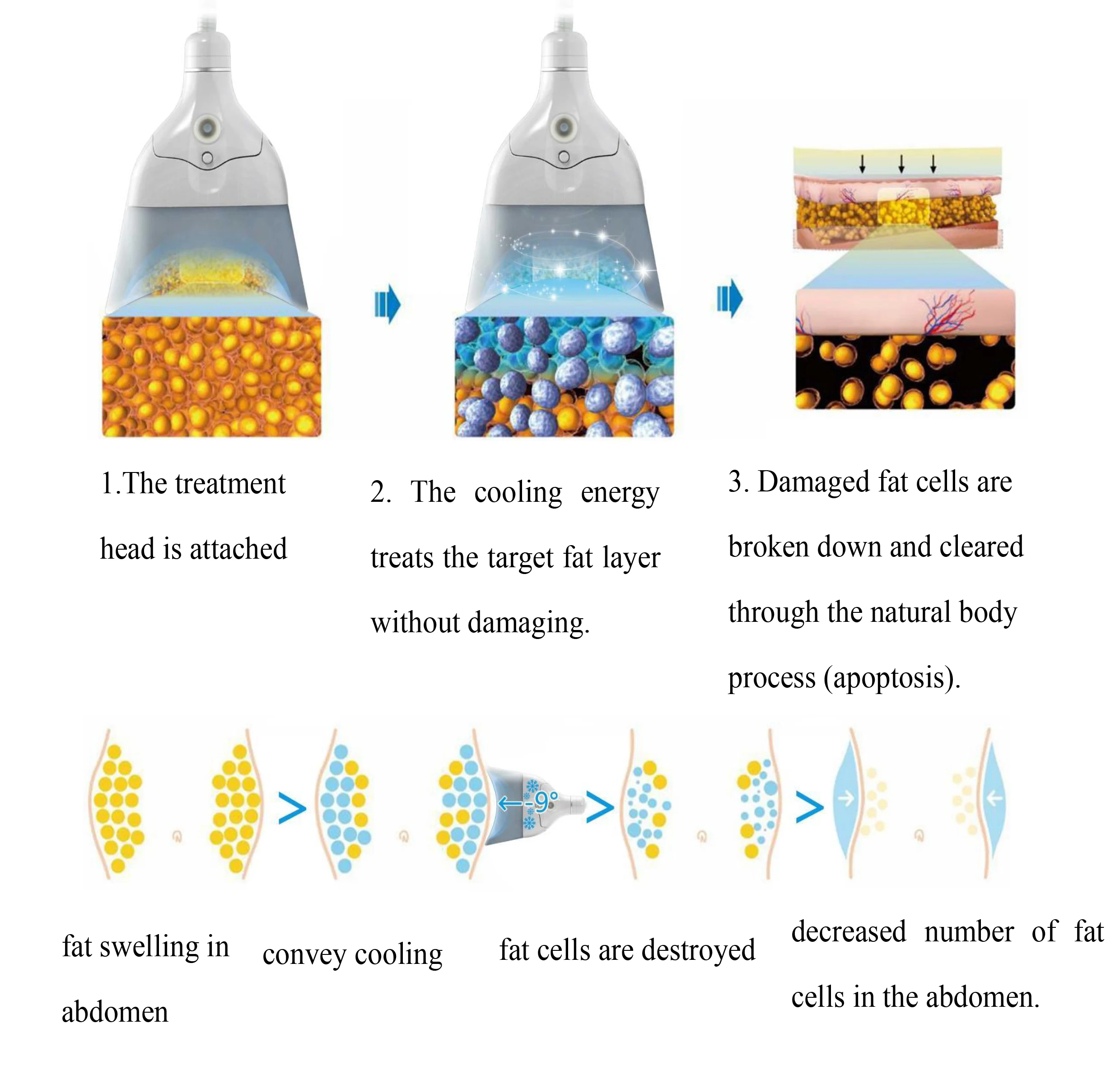 Newest 2021 Dual channel Diamond Ice Sculpture 360 Cryolipolysis machine with 6 probes