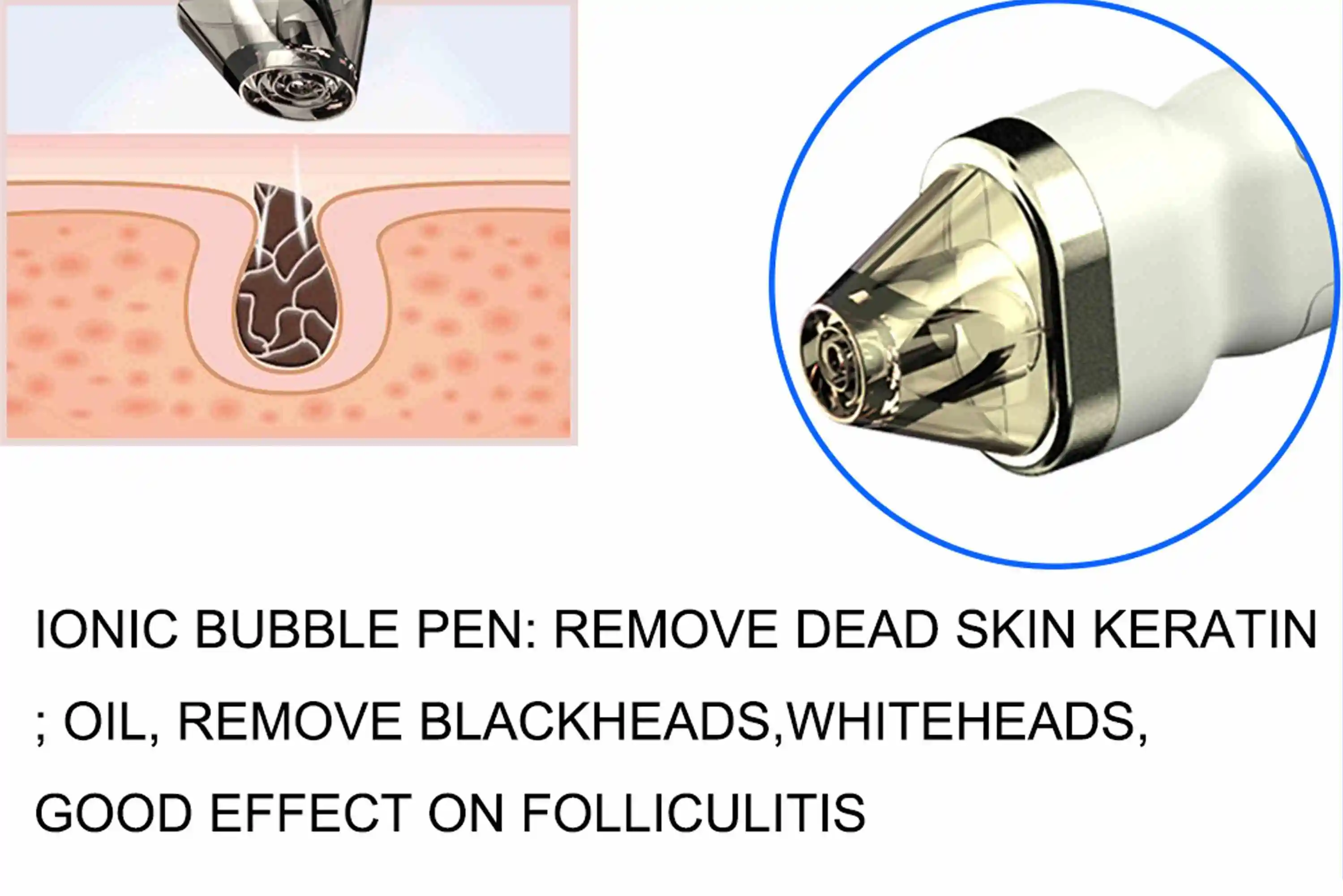 Skin Microdermabrasion Machine Hydrodermabrasion Exfoliation Microdermabrasion Blackhead Remover