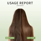 プライベートラベルoemプラスチックボトルヘルスプライベートラベルヘアシャンプーとコンディショナーセット育毛シャンプー