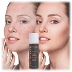 Liquid Exfolicant Salicylic Acid Acne Treatment Repair Face Serum Blackhead Remover Skin Care Salicylic Acid Serum