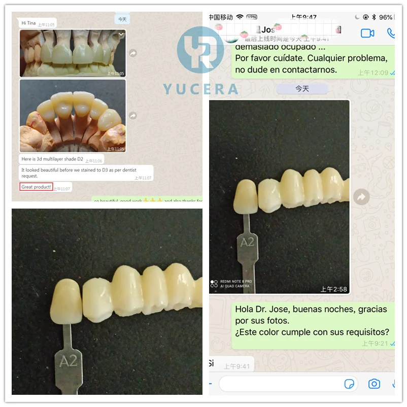 YUCERA ST White Zirconia Block Dental Lab Use Cad Cam 98mm White Blank Zirconia Blocks for 5 Axis Dental Milling Machine