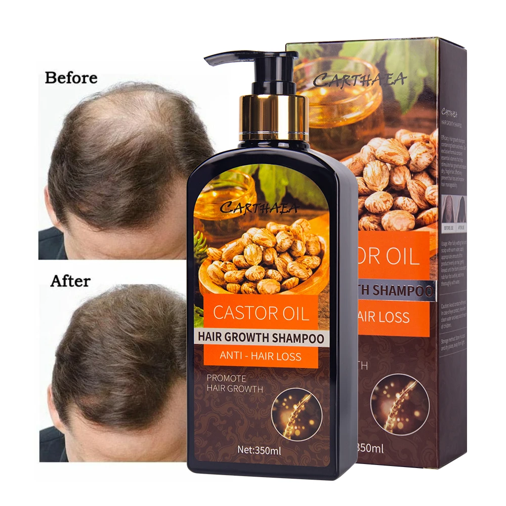 Wholesale natural beauty products anti- hair loss organic ginger shampoo castor oil hair growth shampoo for men and women
