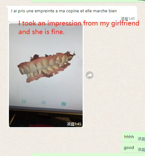 Escaner 3D Intraoral Escner Dental Panda Escner Yucera Dental Intraoral Escaner Intraoral