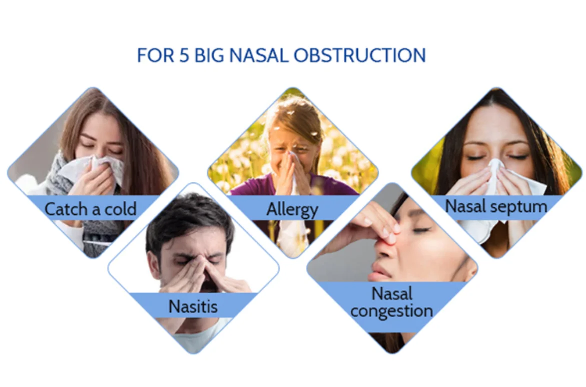 Day/Night Nasal Support Anti-Snoring Nose Strips Breathable Nasal Strips for Sleeping&Sports Oil-Proof&Sweat-Resistant Adhesive supplier