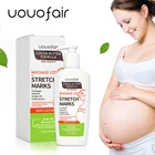 Cream Wholesale OEM/ODM During Pregnancy Effective For Buttocks Dark Legs Old Marks Stretch Mark Removal Cream