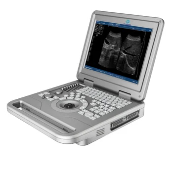SRB-05 3D digital portable ultrasound machine black and white ultrasound scanner for clinic use
