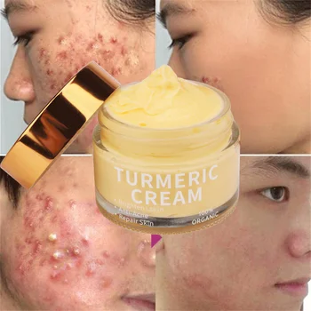 private label Natural vitamin c whitening anti aging Wrinkle acne dark spot remover moisturizing turmeric face cream