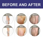 Fat Freeze Slimming Latest Cryo Fat Freezing Lipo Cavitation RF Body Cryotherapy Slimming Machine