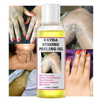 Custom Logo Private Label Body Care Oil Extra Strong Peeling Oil Dark Knuckle Scars Yellow Spots Removal Beauty Personal Care