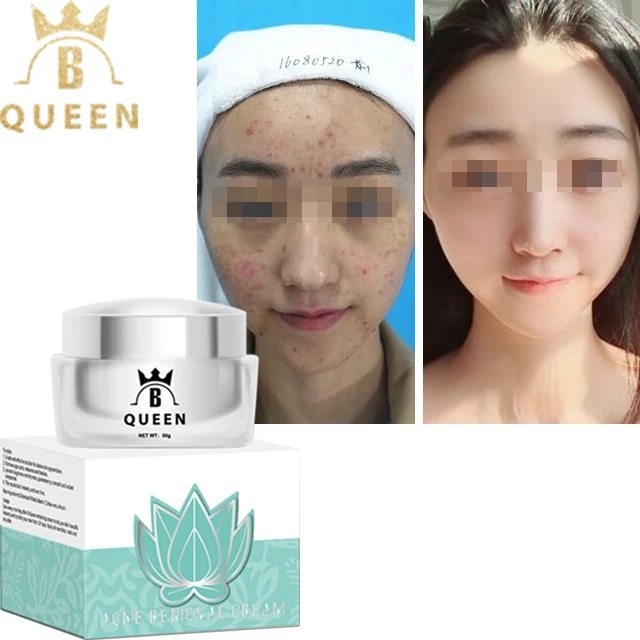 lotion to remove dark spots on face