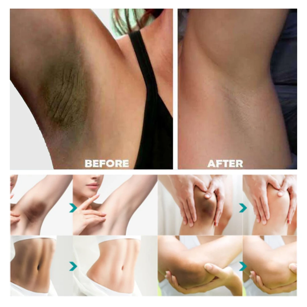 Cosmetics Skin Whitening Underarm Private Body  Armpit Whitening Cream Strong Bleaching Body Lotion Set For Women Dark Skin