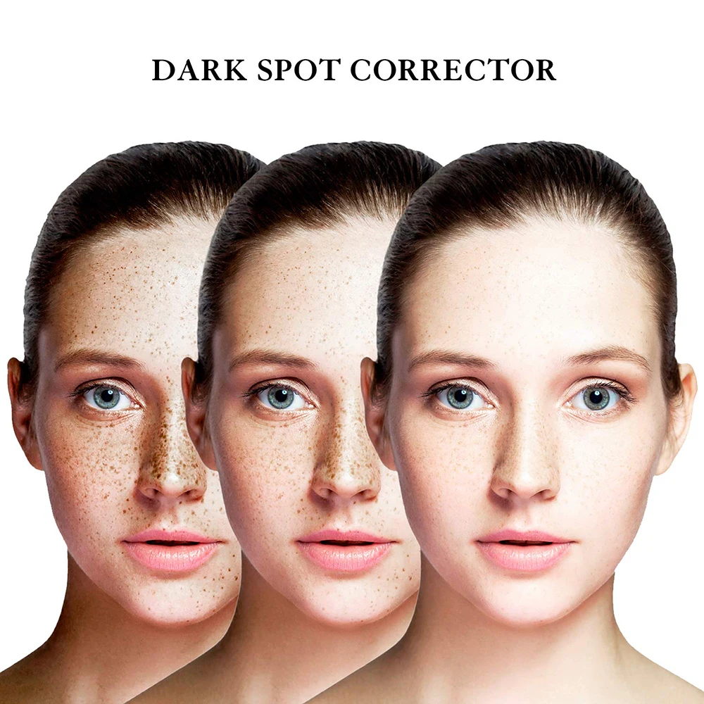 Private Label Freckle Lightening Skin Care Korean Whitening Vitamin C Dark Spot Removal Corrector Serum For Face Treatment