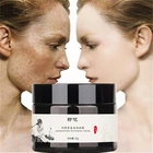 Cream Face Skin Whitening Freckle Remove Melasma Acne Dark Pigment Spots Melanin Pimple Cream Face Cream