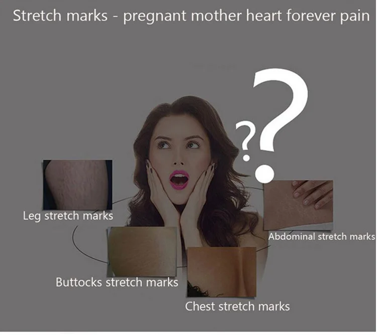 Aichun Beauty Snail Whitening Skin Scar Repair Stretch Removal Marks