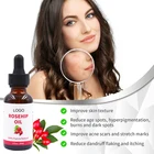 Rose Premium Organic Rose Seed Ingredients Bio-regenerate Rosehip Oil