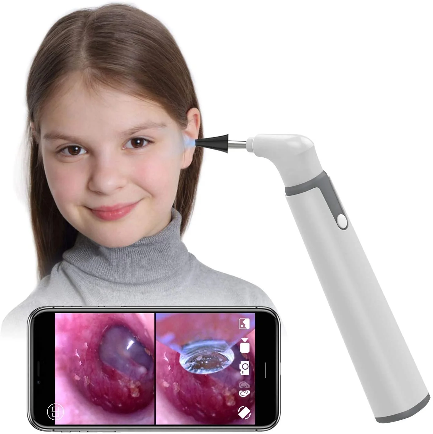 digital otoscope for iphone