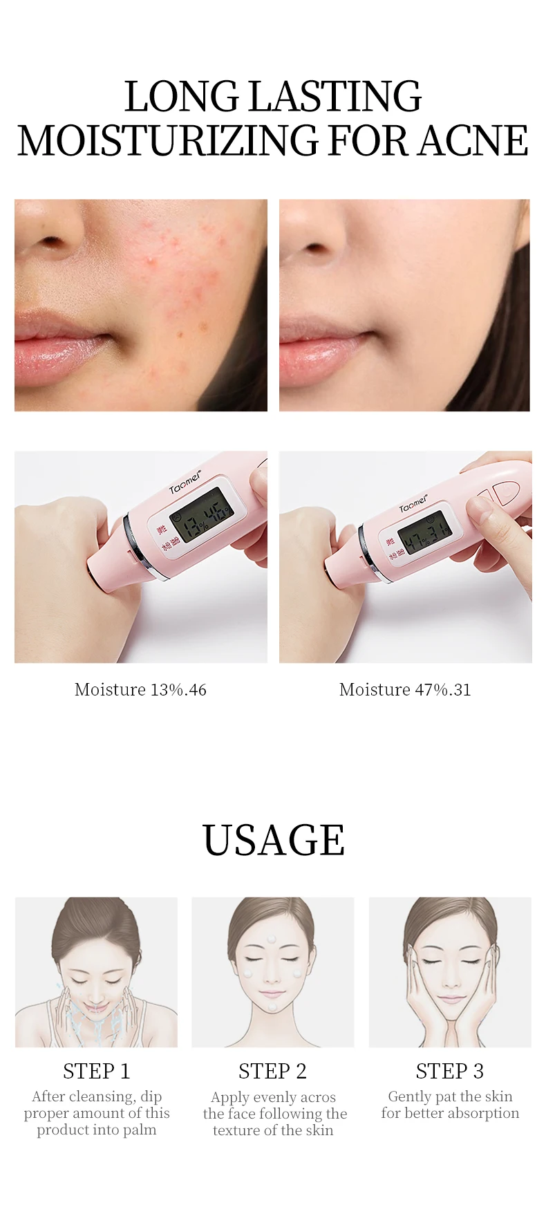 odm veze removing beverage cream pimple acne moisturizer face whitening cream-10