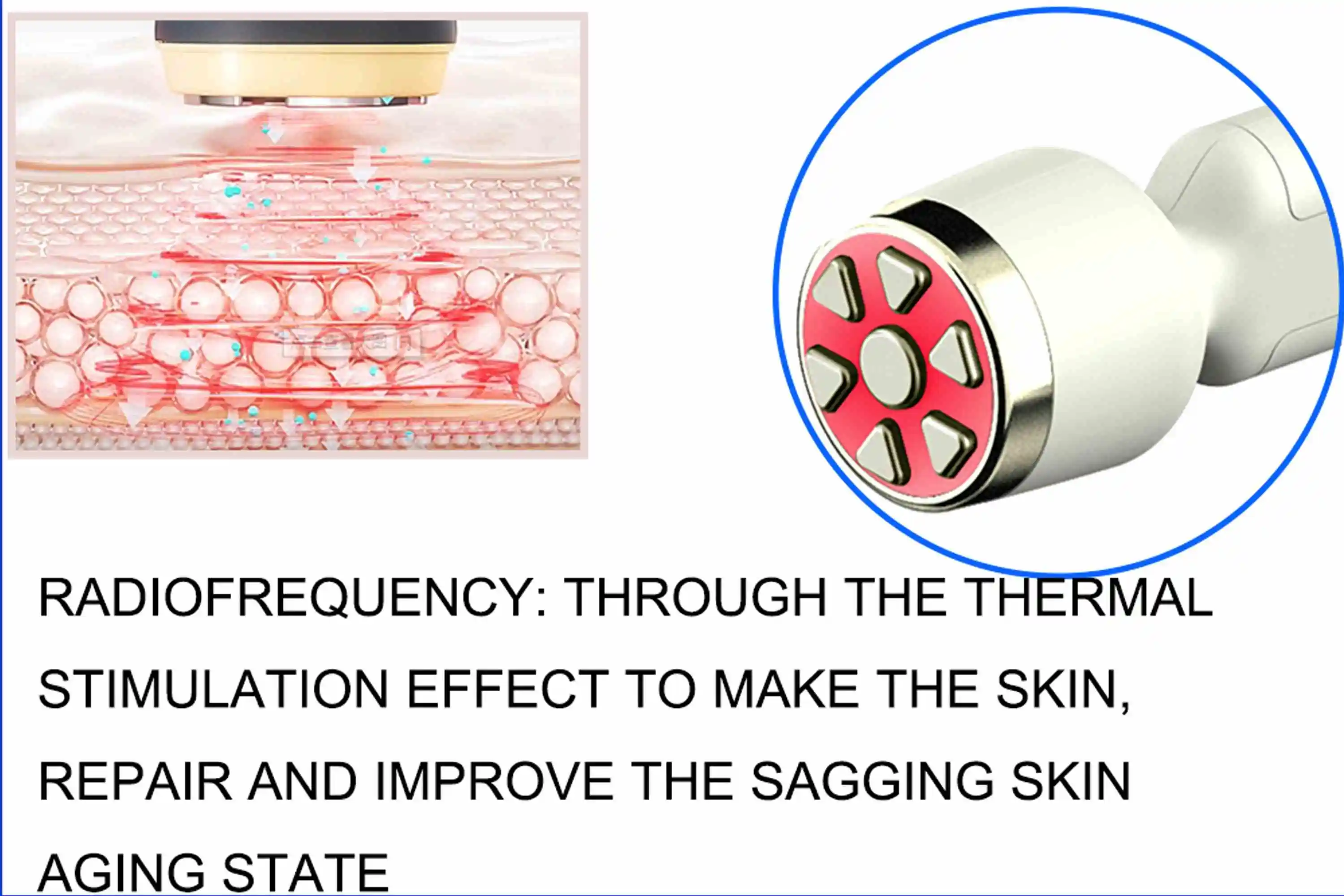 Skin Microdermabrasion Machine Hydrodermabrasion Exfoliation Microdermabrasion Blackhead Remover