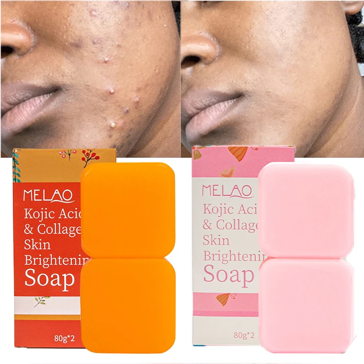Organic Kojic Acid Soap Deep Cleaning Whitening Anti-Acne Face Soap Herbal and Fruit Based Skin Lightening Skincare Feature