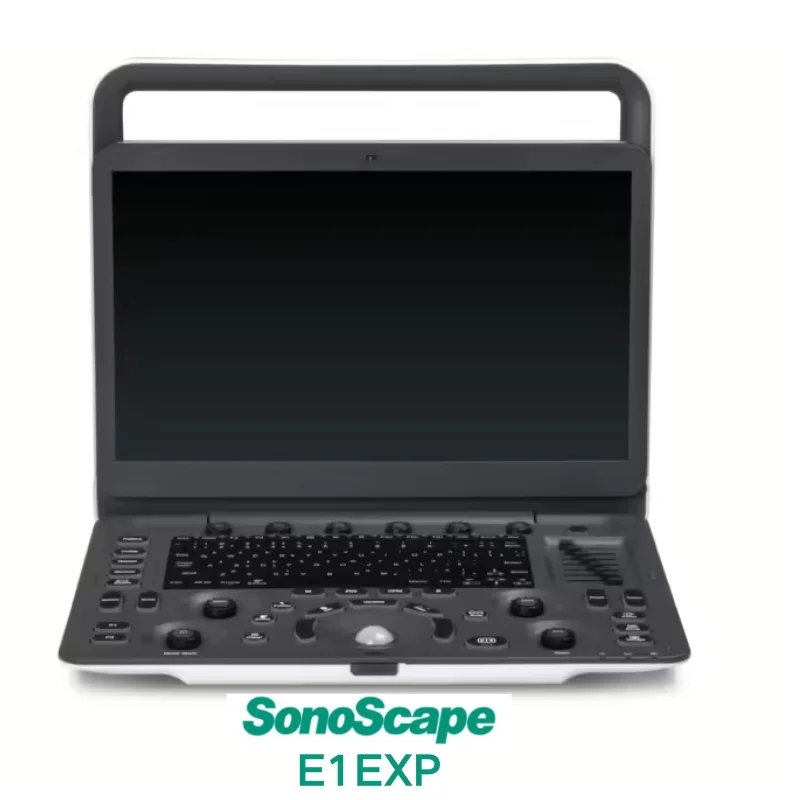 sonoscapee1exp13