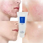 Acne Cream Acne Cream Natural Whitening Anti Wrinkle Acne Scar Treatment Skin Care Moisturizer Face Cream