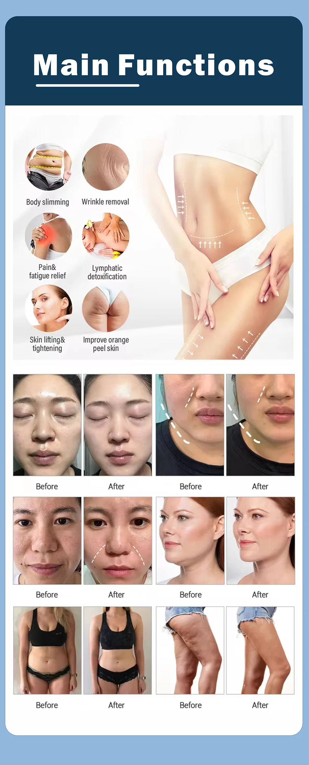 5D 40k Cavitation Vacuum RF Skin Rejuvenation Machine 11 <div> <div class="summary__title"> <h5 class="h4 accordion__title">TECHNICAL SPECIFICATIONS</h5> </div> </div> <div id="ProductAccordion-1c28ceb2-8ff6-4ef1-ada8-722b51b23234-template--16767484887258__main" class="accordion__content rte"> <ul> <li>Machine Power: 150W</li> <li>Cavitation Frequency: 40Khz</li> <li>Voltage: 100V/110V/220V</li> <li>Material: Metal Handle + ABS</li> <li>Cavitation energy: 5-30W/c㎡</li> <li>Radio Frequency(RF): 5 MHz</li> <li><span class="attr-name J-attr-name" title="Technology">Technology: </span>RF + Vacuum + BIO + heat + Cavitation</li> <li>Package Size: 56*54*120cm</li> <li>Package Weight: 27 kg</li> <li> <div>ReturnPolicy: <b class="magic-5">30 Days Money back guarantee</b> <a href="http://skintechx.com/refund_returns" data-sm="true">Return Policy</a></div></li> <li> <div>ShippingDetails: <b class="magic-5">FREE SHIPPING fast delivery</b> <a href="https://skintechx.com/shipping-policy" data-sm="true">Shipping policy</a></div></li> </ul> </div> 5D 40k Cavitation Vacuum RF Skin Rejuvenation Machine