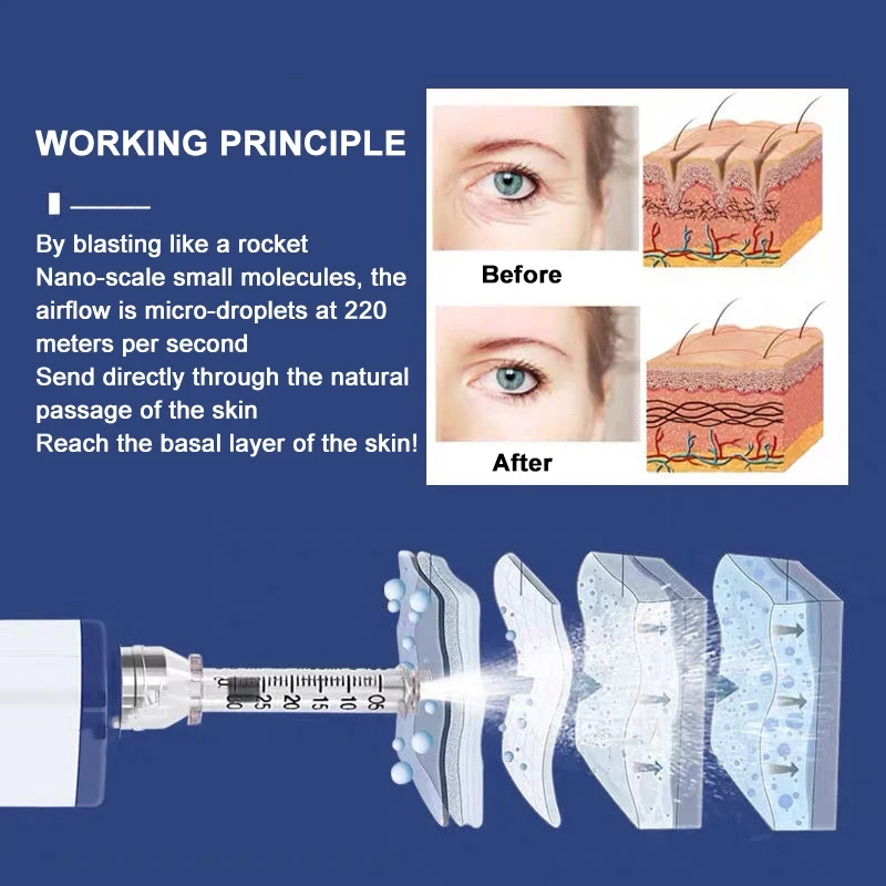 Ручка впрыски сыворотки горячего заполнителя Derma ампулы Needleless продажи электрического Hyaluronic кисловочная 1