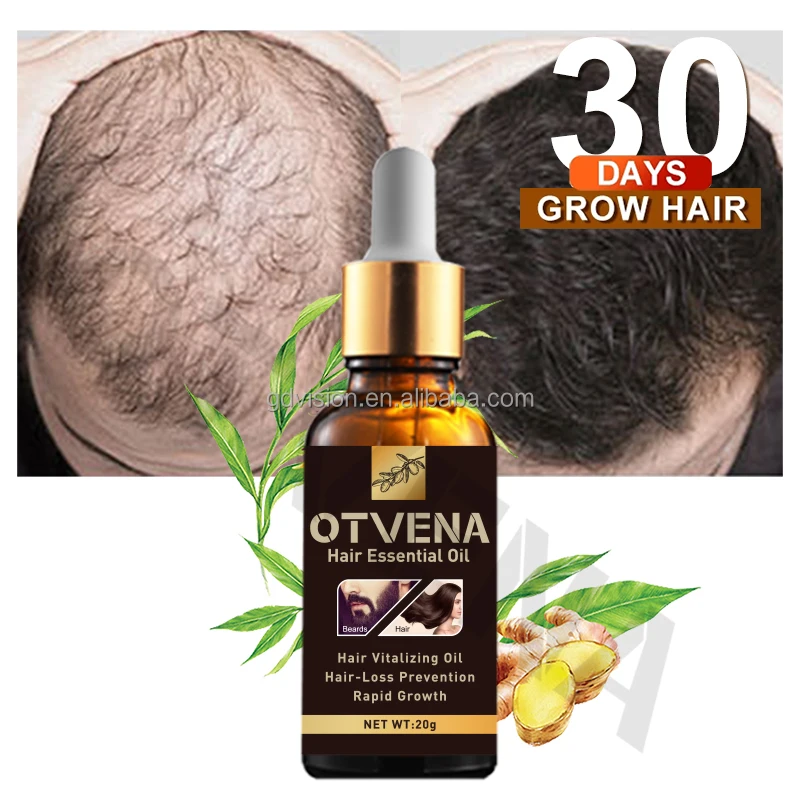 20 Years Gmp Msds Factory Best Hair Growth Oil For Baldness Scalp Repair Hair  Oil Anti Hair Loss - Buy Hair Growth Oil,Hair Oil,Hair Loss Product on  
