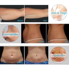 Reduction Shaping Slimming Perfect Effect Body Shaping Slimming Machine Fat Freezing Reduction Equipment