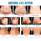 Amazon Best Selling 3 Handles Fat Loss Machine Coolsculption Fat Freezing Machine Cryolipolysis