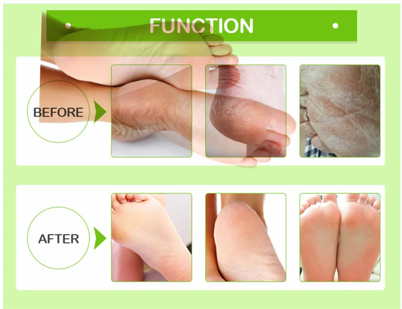 foot care  (5).png