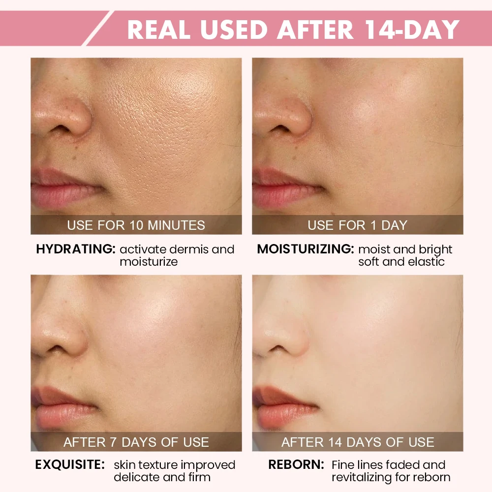 Korean Cosmetics Organic Skin Care Products Hyaluronic Acid Vitamin C Whitening Anti Aging Face Serum Cream Skin Care Set