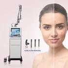 Co2 Vaginal Laser Sincoheren Exmatrix Co2 Laser Monalisa Touch Scanning Vaginal Tightening Medical Grade Laser