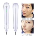 Laser Pen Removable Pen Laser Freckle Removal Machine Skin Mole Dark Spot Face Wart Tag Remover Pen