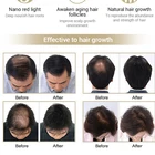 Hair Treatment Growth Hair Loss Treatment Electric Comb Head Massager Improve Hair Growth Treatment Infrared Light Therapy Hair Straightener Comb
