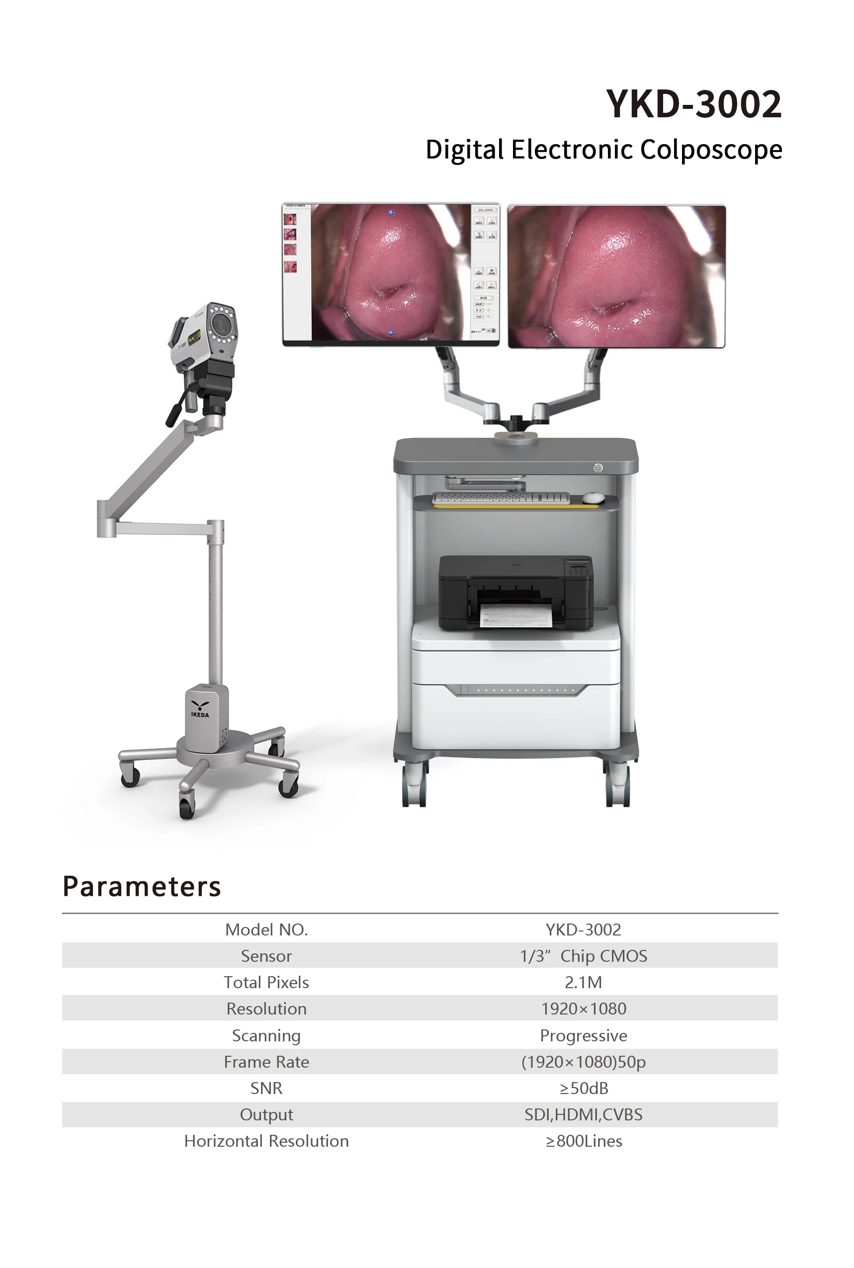 Full Hd Colposcope Camera For Vagina Colposcopy Buy Colposcope Camera