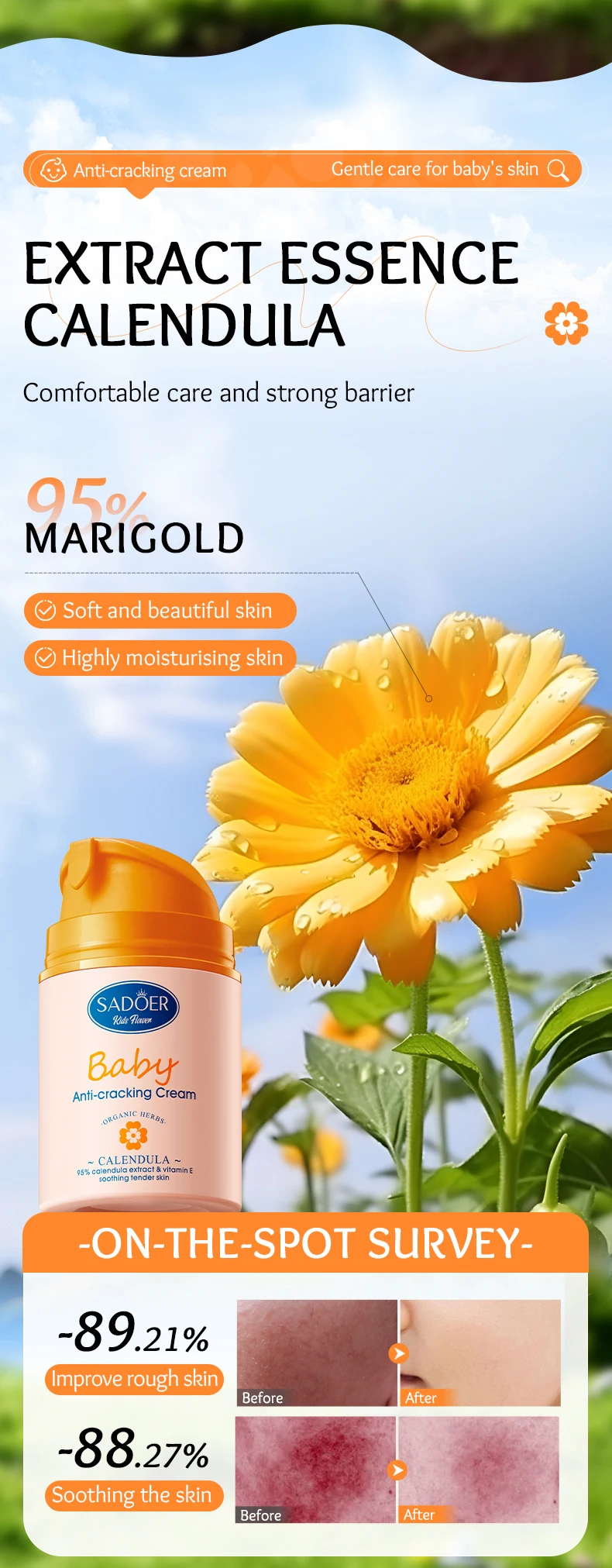 product organic skincare sadoer childrens calendula vitamin e gentle soothing anti chafing repairing moisturizing cream for children-5