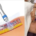 Combines Cryolipolysis Electropration And Shock Wave Therapy Slimming Multi-function Beauty Equipment