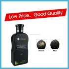 Shampoo Hair Loss Shampoo Anti Hair Loss Shampoo With 14 Dht Blockers