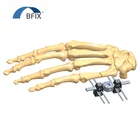 Orthopedic External Fixator For Fracture Of The Shaft Of The 5th Metacarpal Mini Fixator