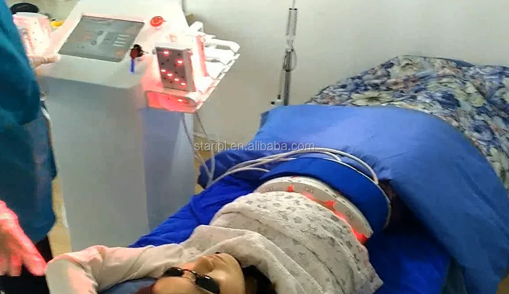 lipo laser (2)