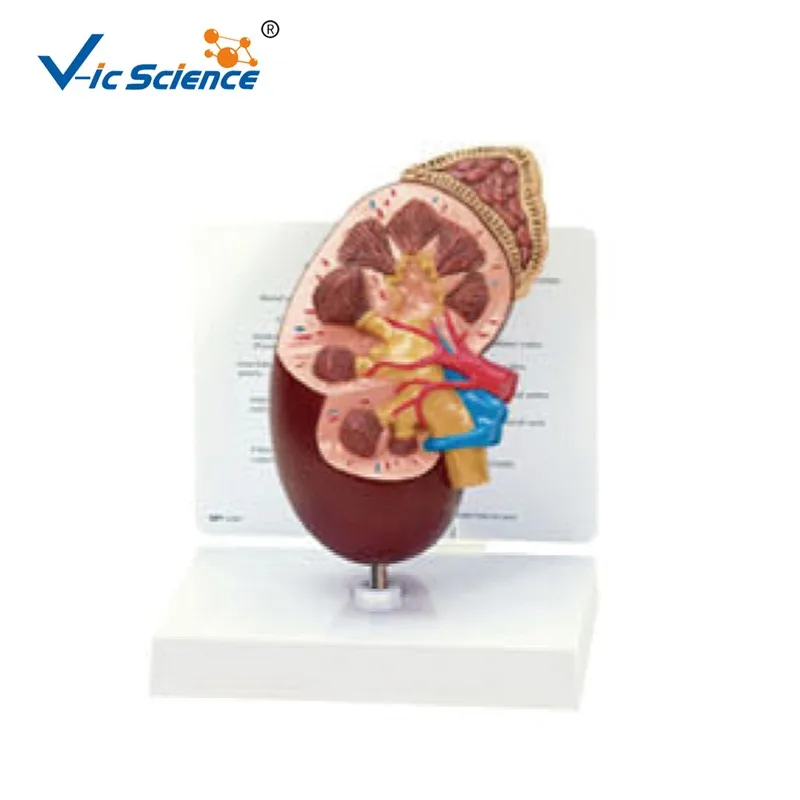 human kidney dissection