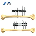 Short System Short Humeral Diaphysis Limb Reconstruction System In Place Osteotomy Performed