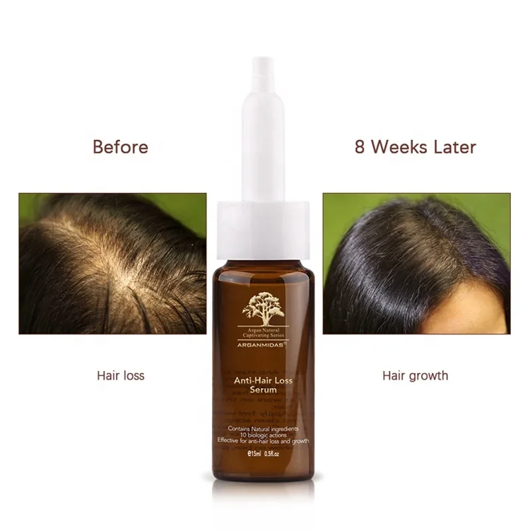 Oem Malaysia Platycladus Orientalis Extract Hair Tonic Ginger Hair Growth  Oil Serum - Buy Hair Tonic Serum,Oem Hair Tonic Malaysia,Ginger Hair Growth  Oil Product on 