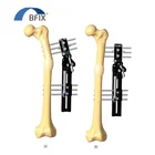 L.R.S. Fixator Acute Shortening And Correction By Callus Manipulation And Completion Of Lengthening