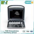 System Promotion CE Approved Chison ECO1 Advanced Low Price Portable BW Chison Ultrasound System