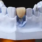 Zirconia System Zirconia Teeth Dental Implant System